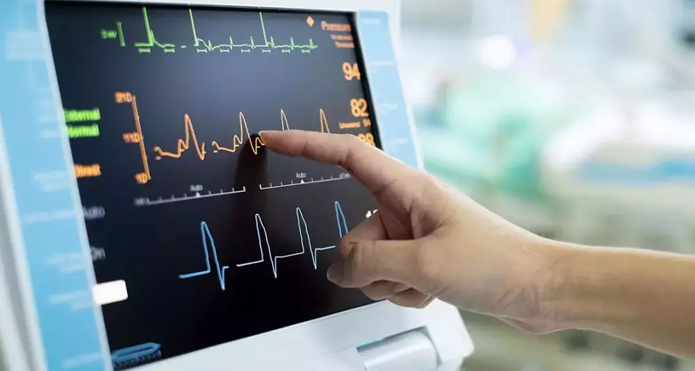 Electrocardiograph: Structure, Function, and Clinical Interpretation