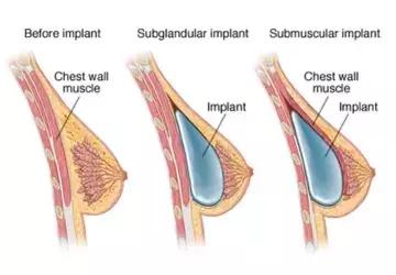 Struggling with Sleep? Discover the Best Sleeping Aids for Restful Nights