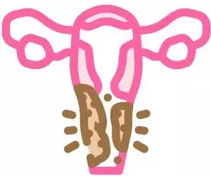 Are you itching to the point of collapse? Here is the 3-day eczema savior that can relieve itching