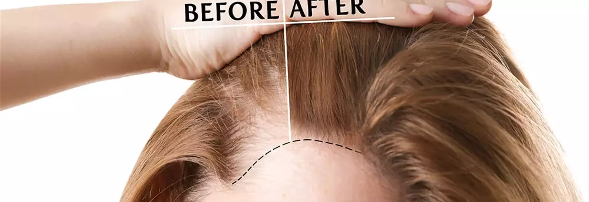 Understanding Depression Tests: A Step Toward Better Mental Health