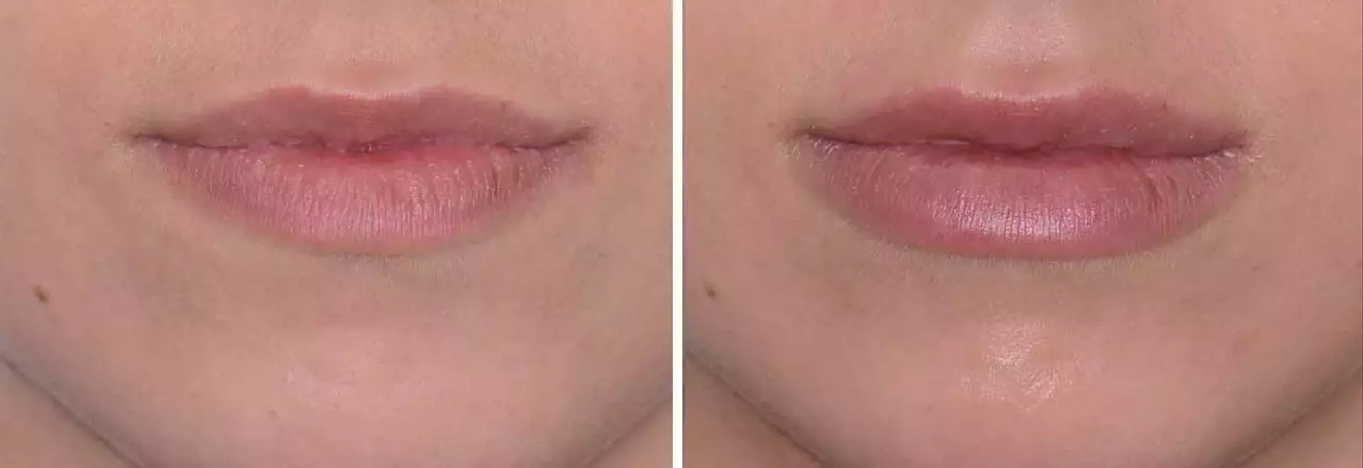 How Medicaid Can Help Cover the Cost of Hearing Aids