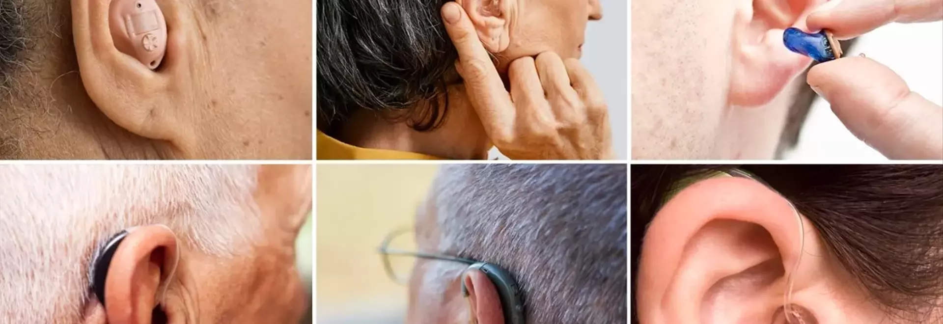 Rediscover Your Radiance: The Ultimate Guide to Rhytidectomy (Facelift)