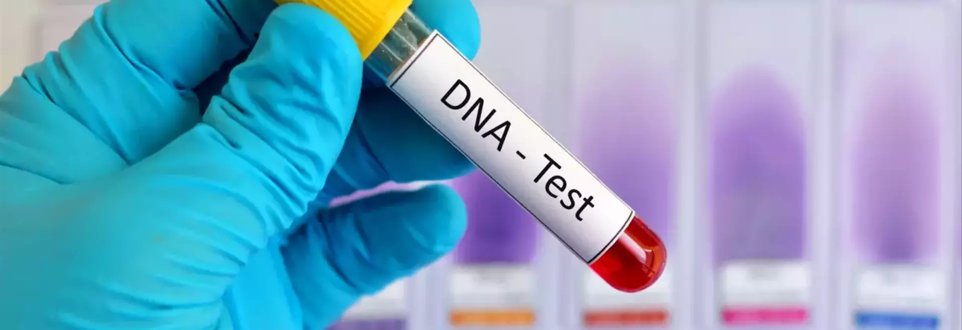 Dental Implants vs. Dentures: Key Differences in Function and Maintenance