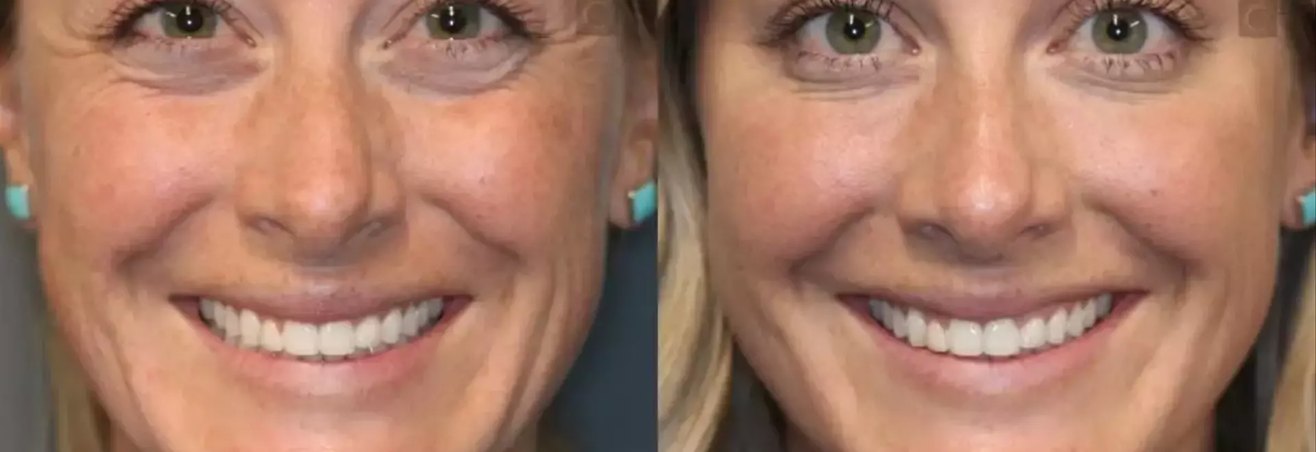 Psoriasis Treatment Uncovered: From Skincare to Cutting-Edge Biologics