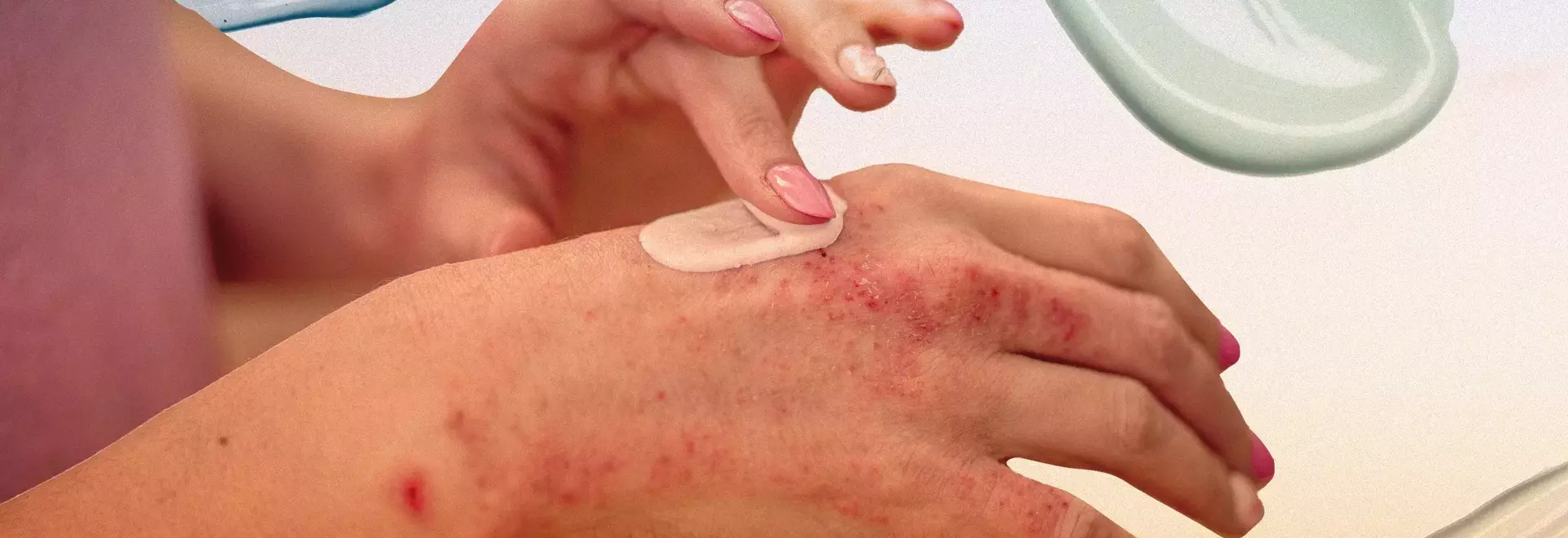 Cancer Care in 2025: Navigating Support, Innovation, and Hope