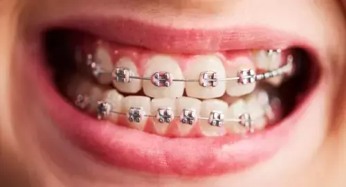 How to Remove Wrinkles from Face Quickly: Effective Solutions That Work