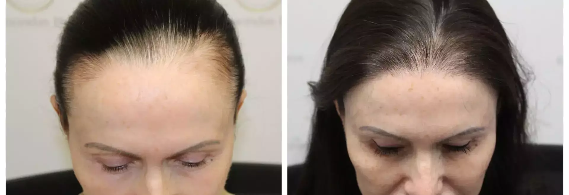 You thought you were just gaining weight—What you need to know about obesity