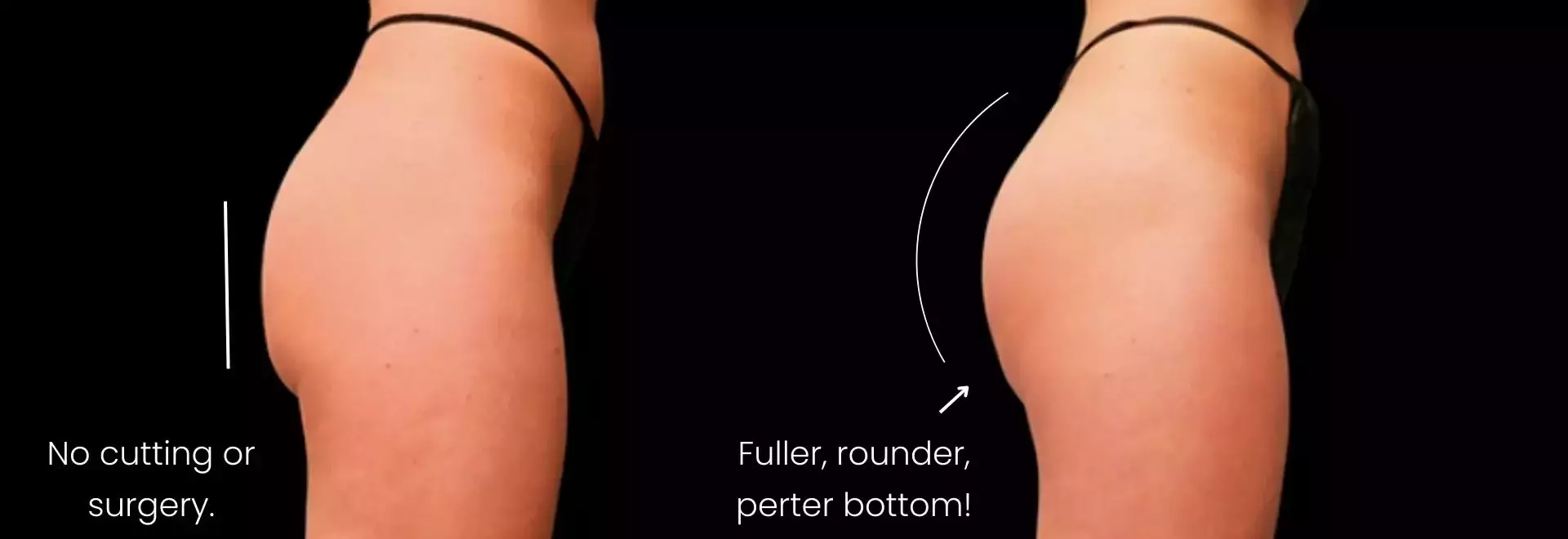 Melasma Treatment Near Me: Find the Best Options for Clearer Skin