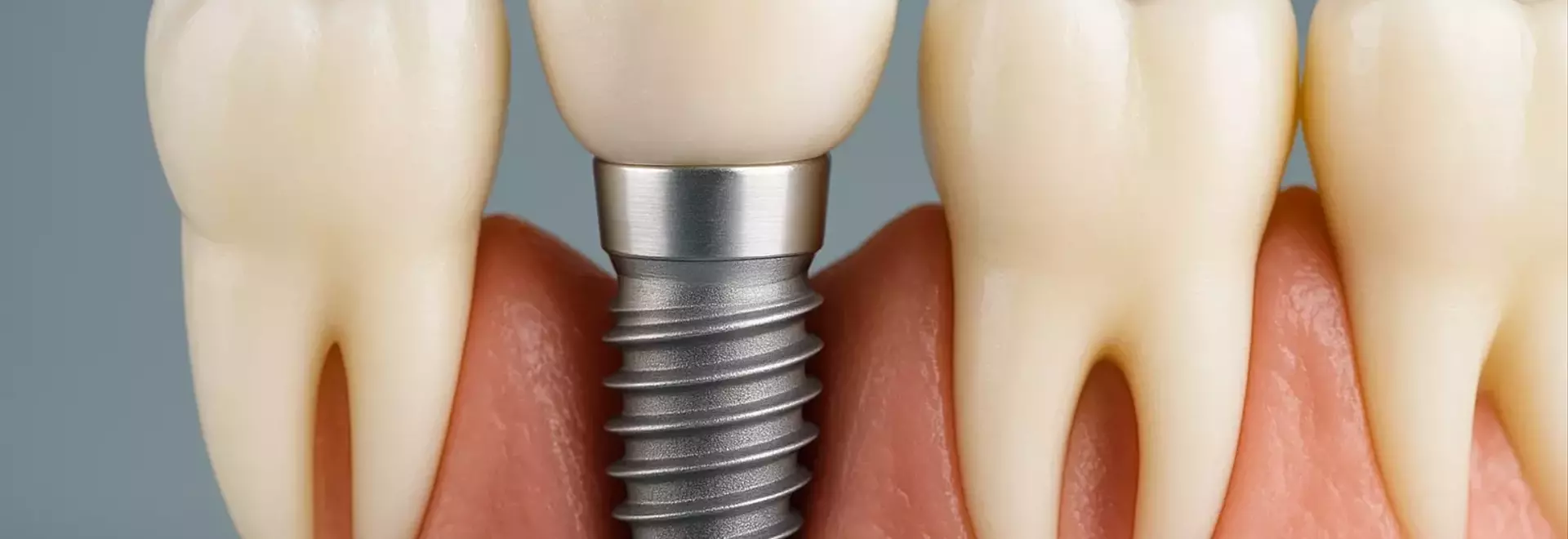 Effective Strategies on How to Slow Down Dementia and Boost Cognitive Health