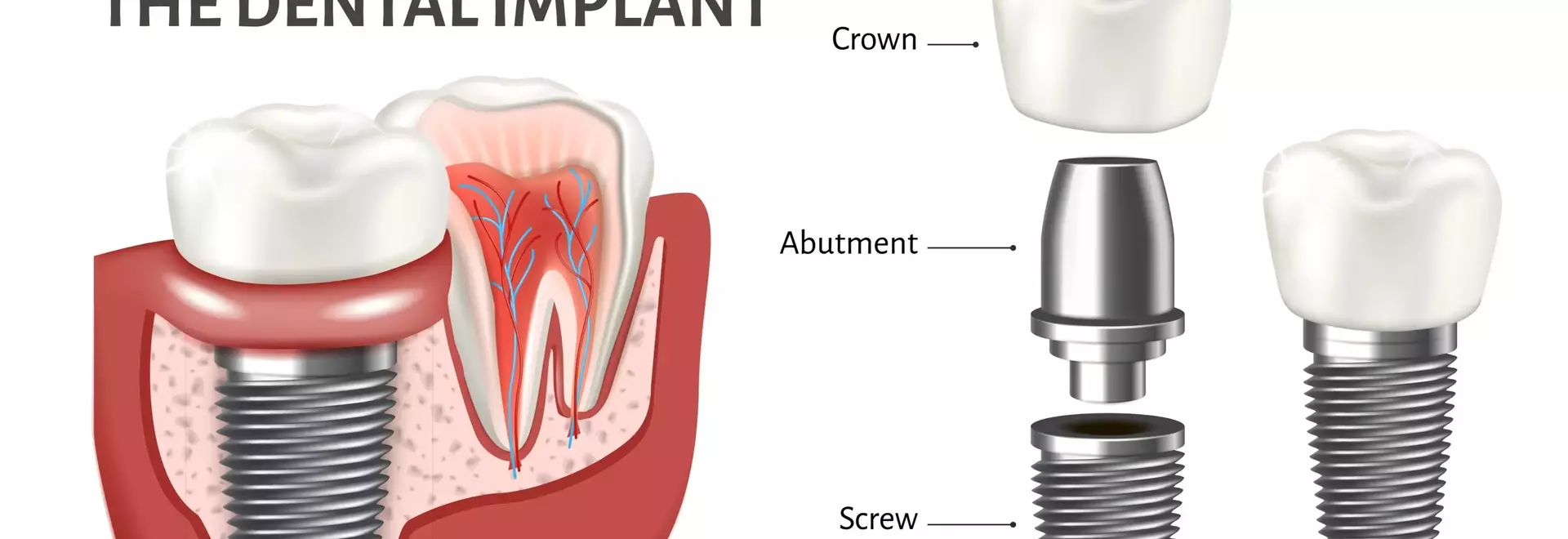 Complete Guide to Hair Transplant Clinics: From Diagnosing Hair Loss to Choosing Techniques
