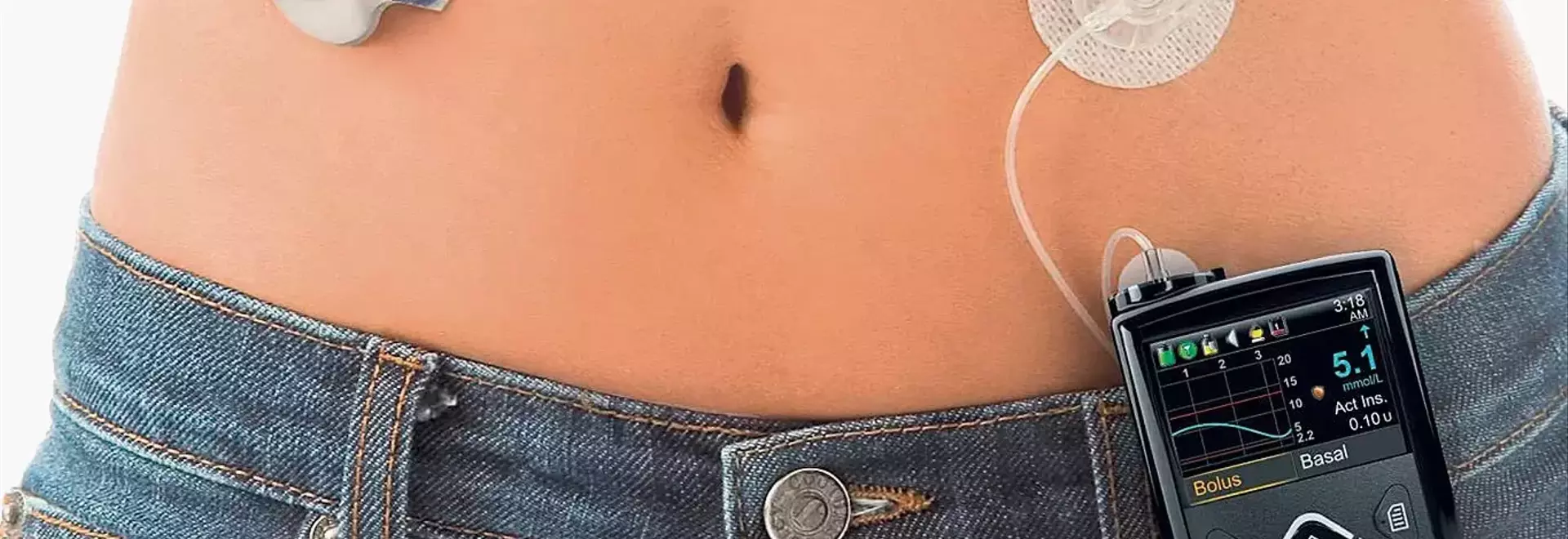 Home Electrocardiogram Devices: A Guide to Understanding Personal Heart Monitoring Technology