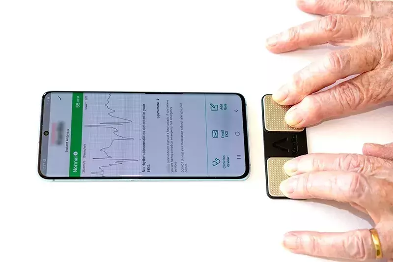 What Is a Blood Pressure Monitor and Who Uses It?