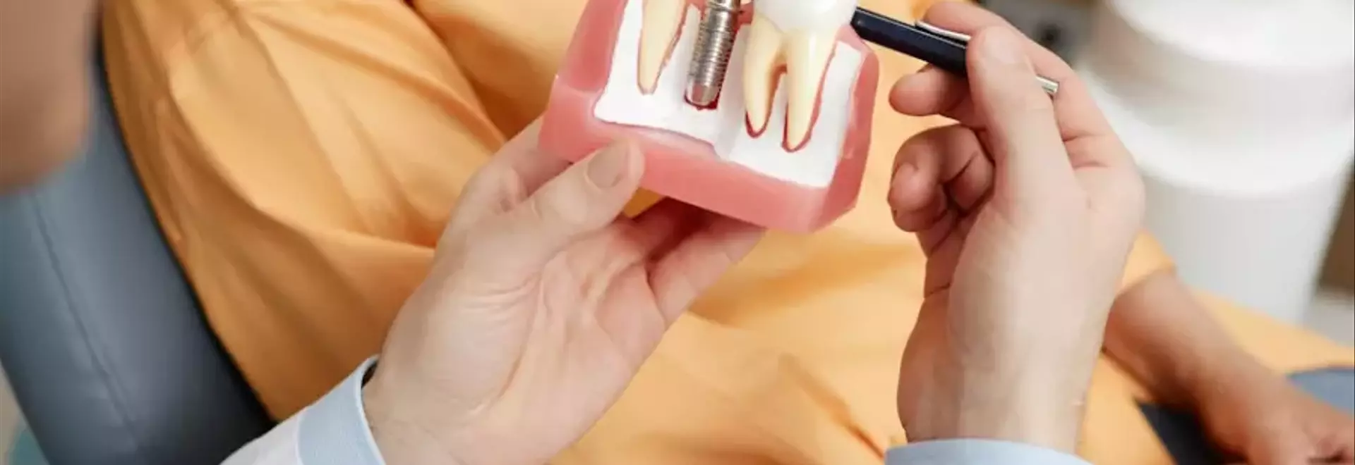 Cura post-intervento implantare: guida all'alimentazione