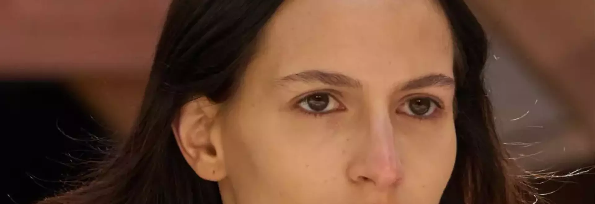 Invecchiamento Cutaneo: Processo e Strategie di Rallentamento