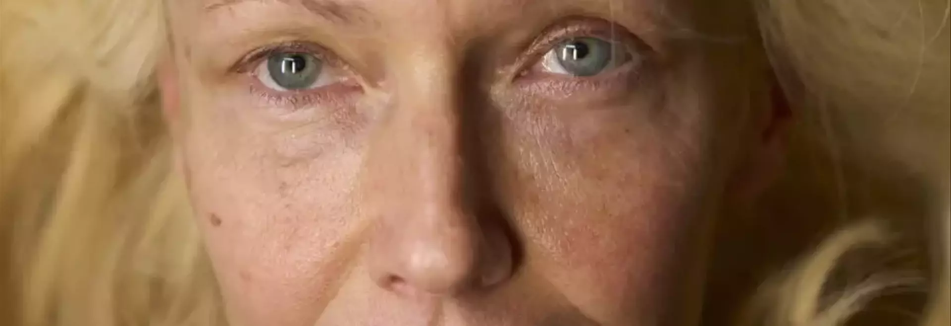 Cura della pelle in menopausa: mantenere giovinezza e vitalità