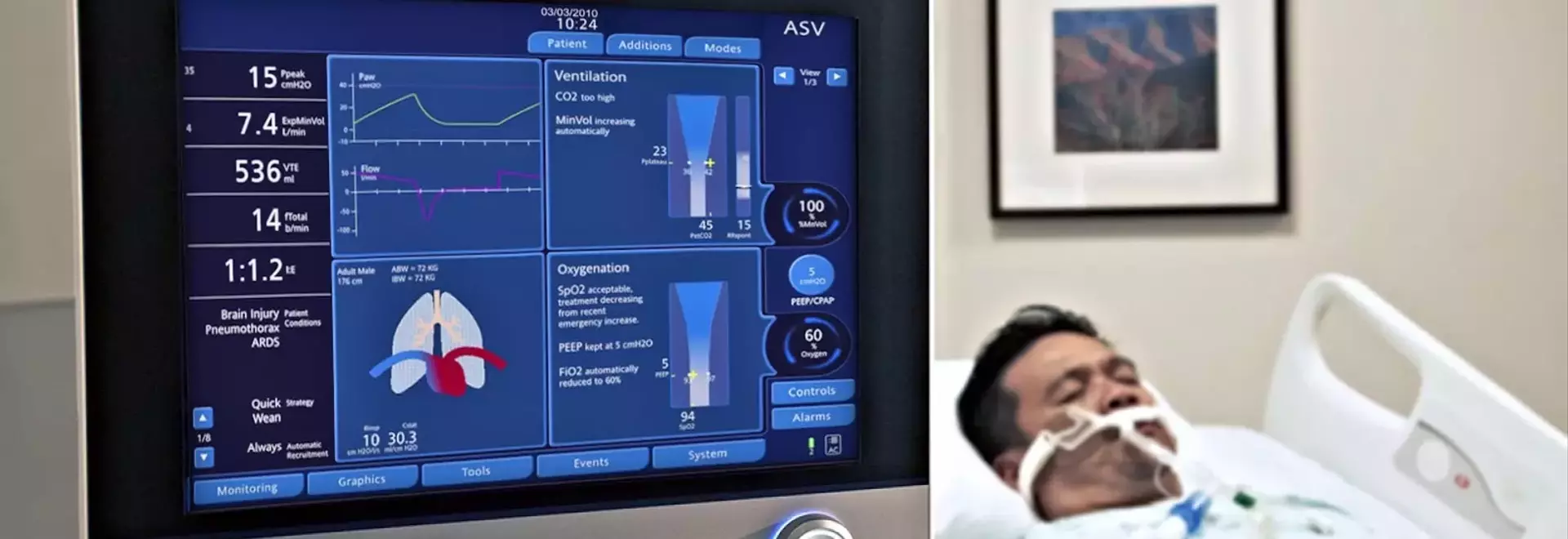 X-Ray Machines: A Scientific Overview of Principles, Technology, and Clinical Context