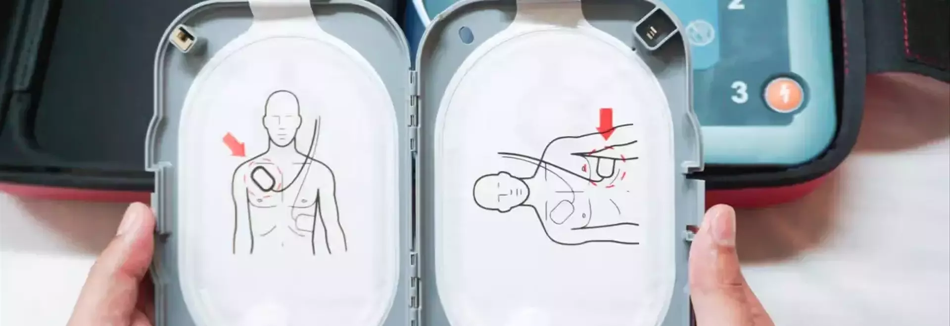 Cardiac Monitor: A Neutral Scientific Overview of Principles, Functions, and Clinical Context