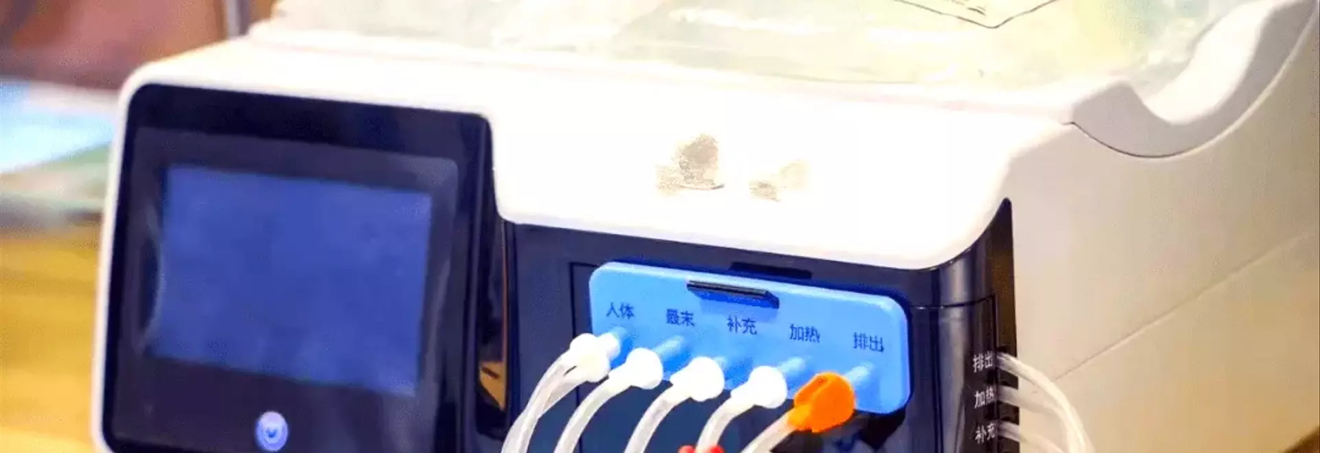 Ultrasound Equipment: Principles, Functions, and Clinical Applications