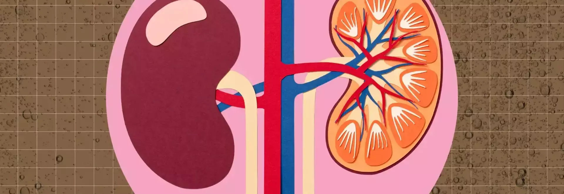 The Impact of Dark Sodas on Kidney Health