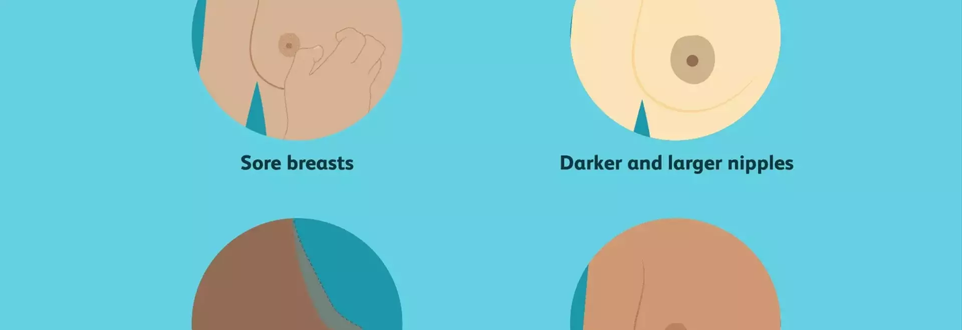 Understanding Breast Transformations During Pregnancy: A Comprehensive Guide