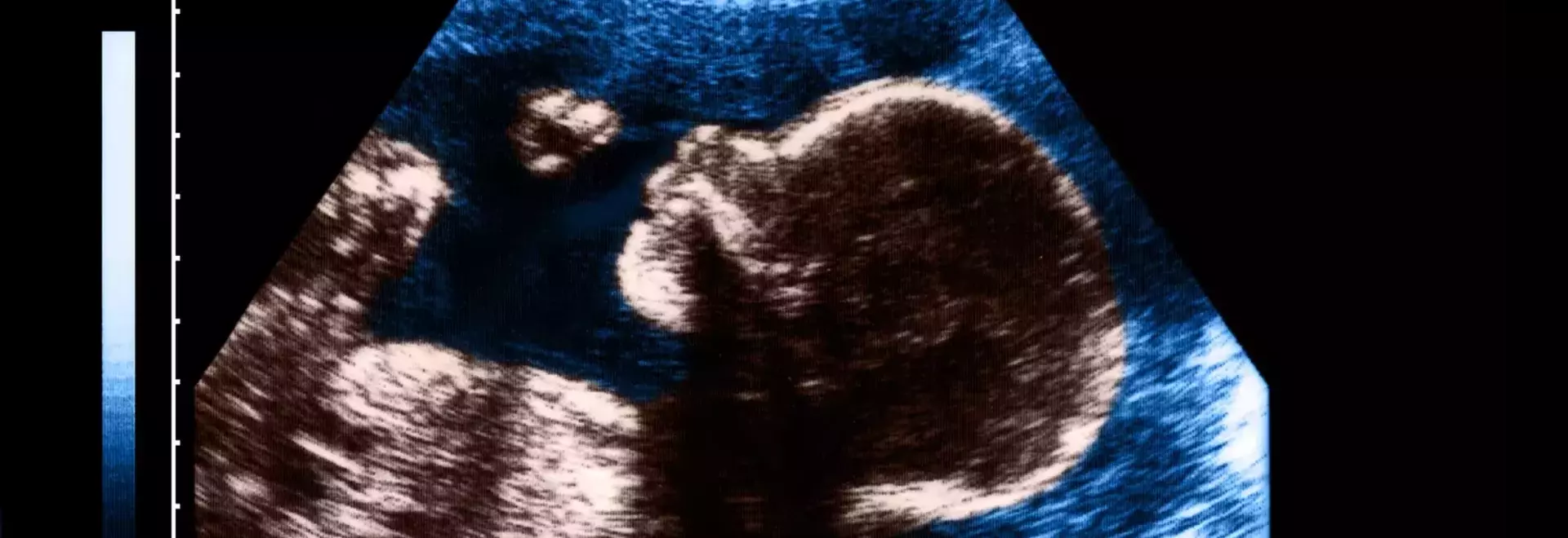 The Art and Impact of Pregnancy Nicknames