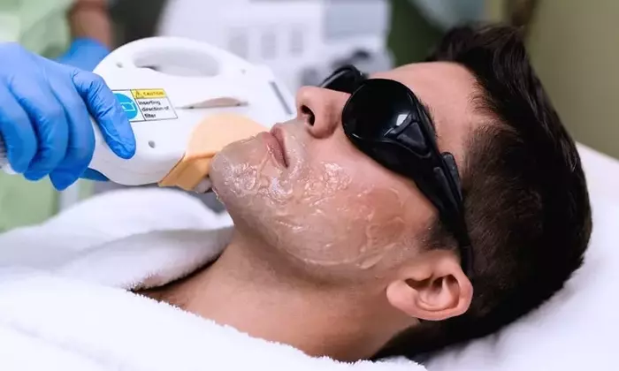 Laser Hair Removal: A Comprehensive Guide to Understanding the Technology