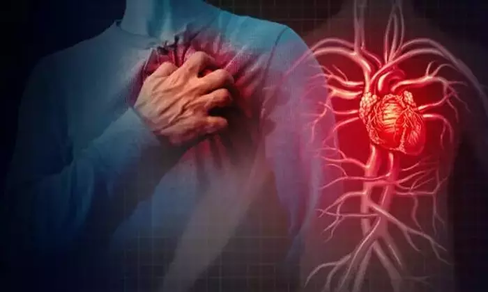 Understanding Heart Disease: A Comprehensive Scientific Overview