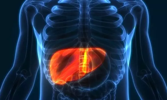 Understanding Fatty Liver: A Comprehensive Scientific Overview