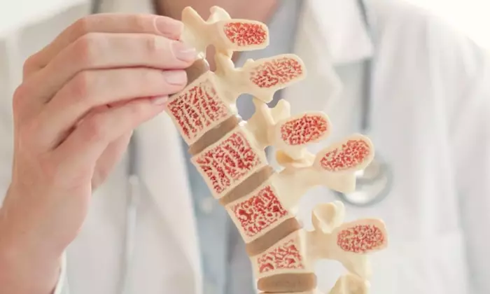 Understanding Osteoporosis: A Scientific and Technical Overview