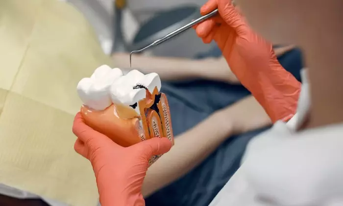 Root Canal Treatment: Understanding Dental Procedures for Tooth Preservation