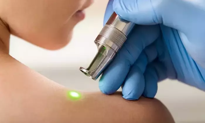 How Laser Medical Devices Are Used in Treatment: A Technical Overview