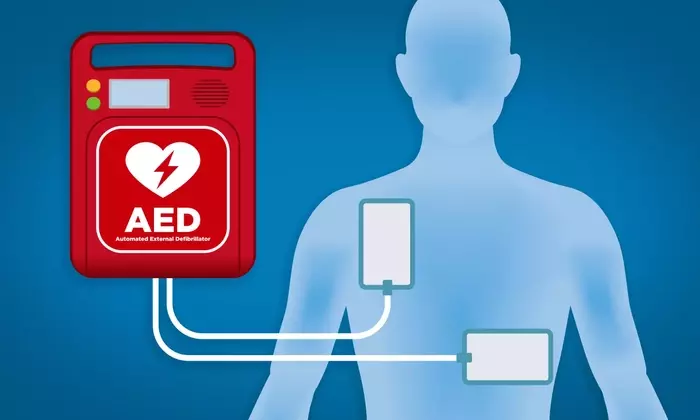 Automated External Defibrillators (AEDs): A Technical and Clinical Overview