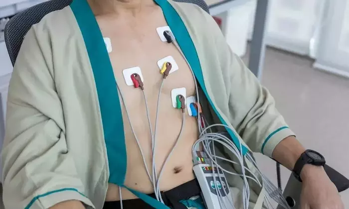 Holter Monitors: A Technical and Clinical Overview