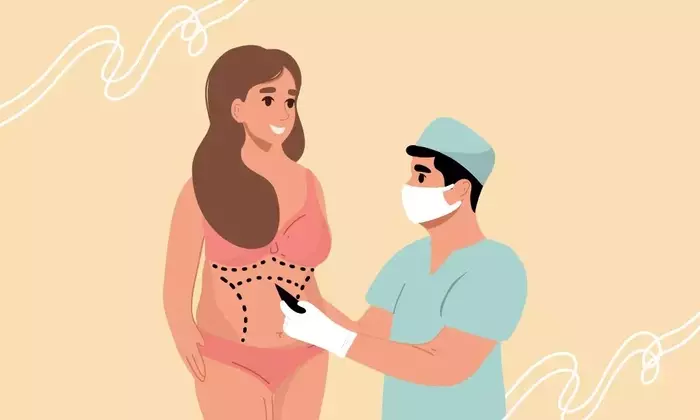 Understanding Abdominal Liposuction: A Comprehensive Scientific Overview