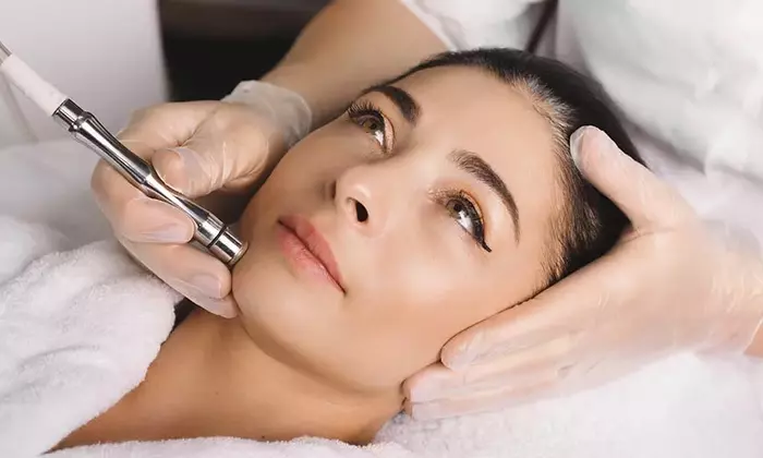 What Is Microneedling and How Does It Improve Skin?