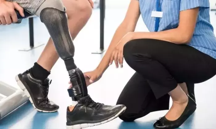 Understanding Prosthetics: A Comprehensive Scientific Overview