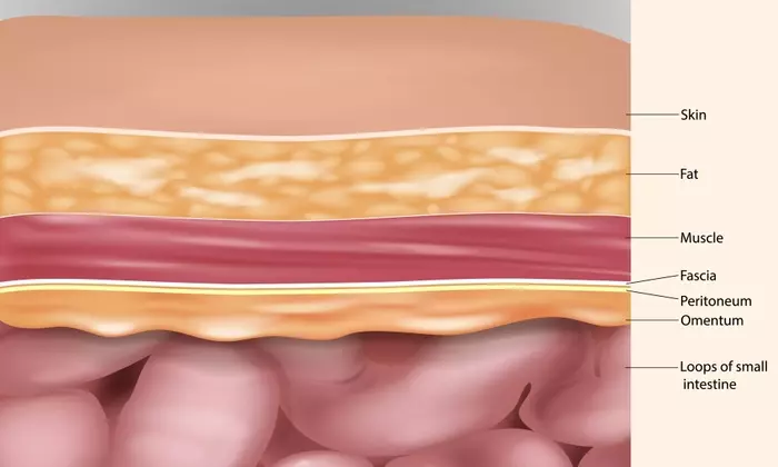 Understanding Abdominoplasty: A Comprehensive Scientific Overview