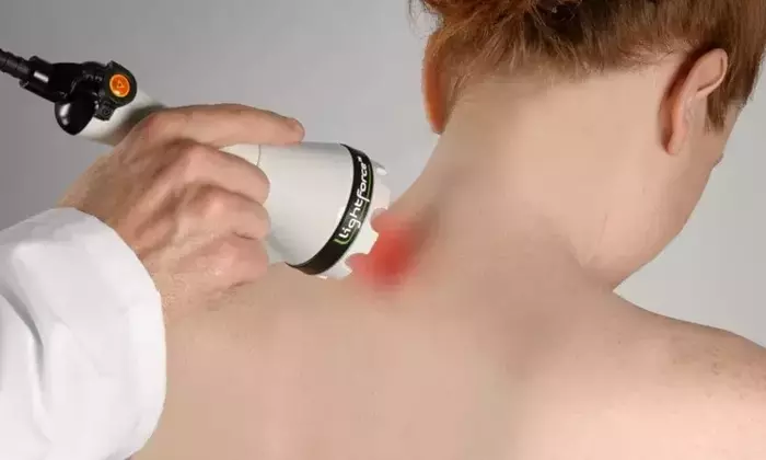 Understanding Scar Repair: A Comprehensive Scientific Overview