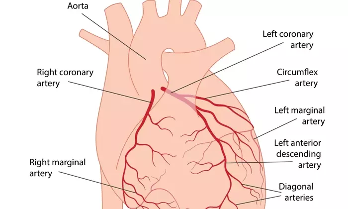 Understanding Coronary Artery Disease: A Comprehensive Scientific Overview