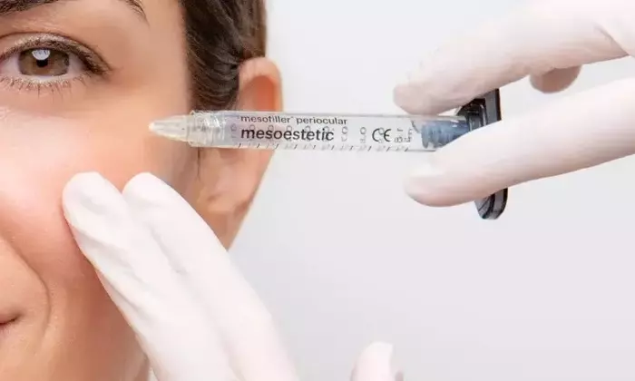 Chirurgie laser des poches sous-oculaires