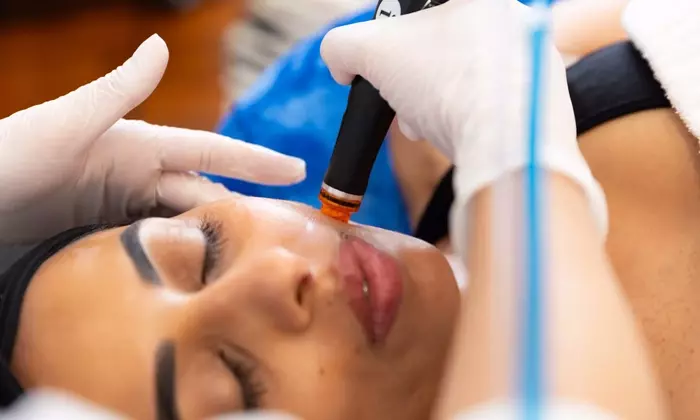 Ultrasound Technology in Aesthetic Medicine: Core Principles and Mechanisms