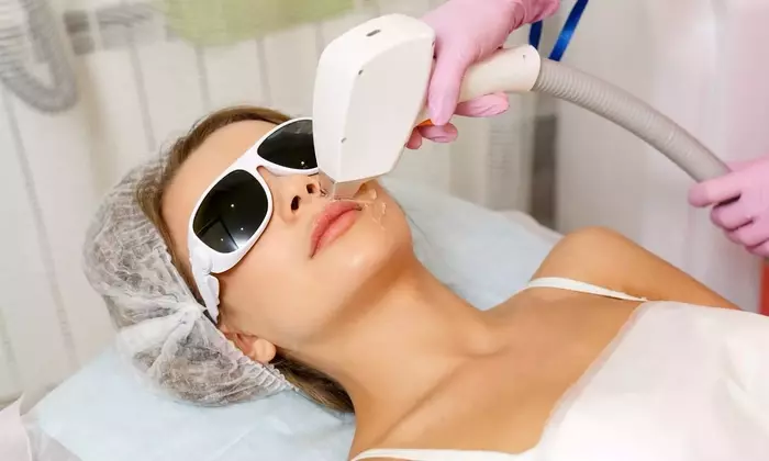 Microneedling: The Biophysical Principles of Controlled Injury and Dermal Remodeling