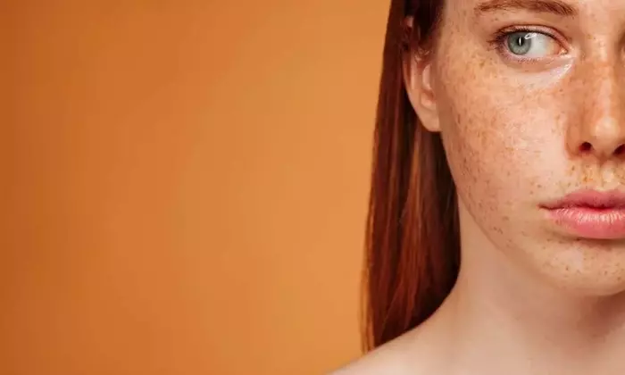 Laser Treatment for Skin Pigmentation: A Scientific Overview of Principles,