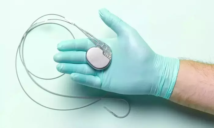 Cardiac Pacemakers: A Scientific Overview of Principles, Mechanisms, and Clinical Context