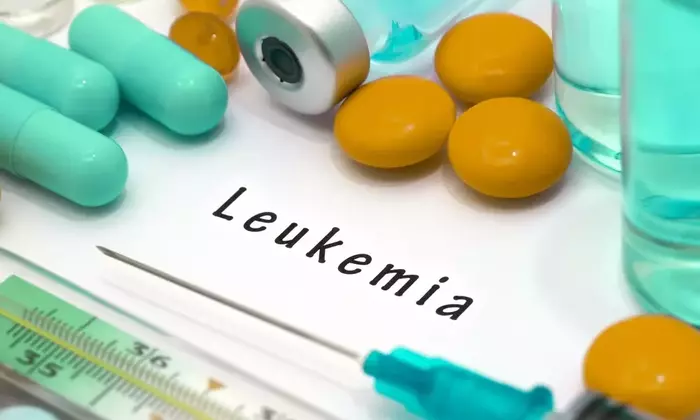Navigating Leukemia Treatment in the U.S.: Modern Strategies and Personalized Care