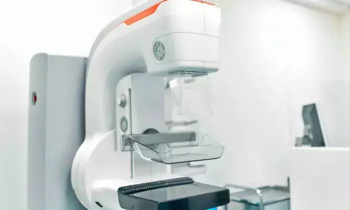 Mammography Equipment (Breast X-Ray System): A Neutral Overview of Technology