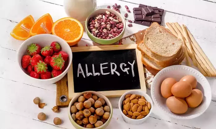Food Allergy Management Consultation: Concepts, Mechanisms, and Public Health Context