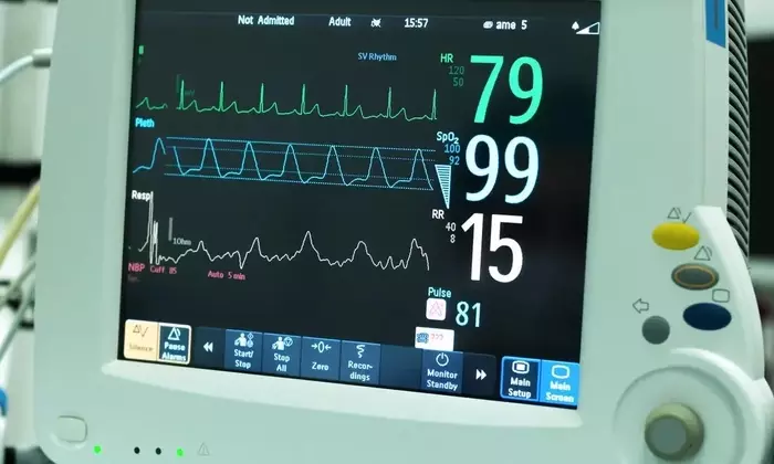 Electrocardiographic Monitors: What They Are, How They Work, and What the Evidence Shows