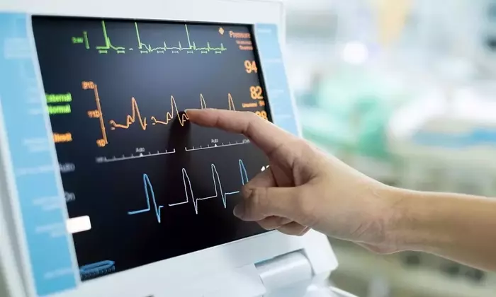 Electrocardiograph (ECG) Machines: Principles, Functionality, and Clinical Overview