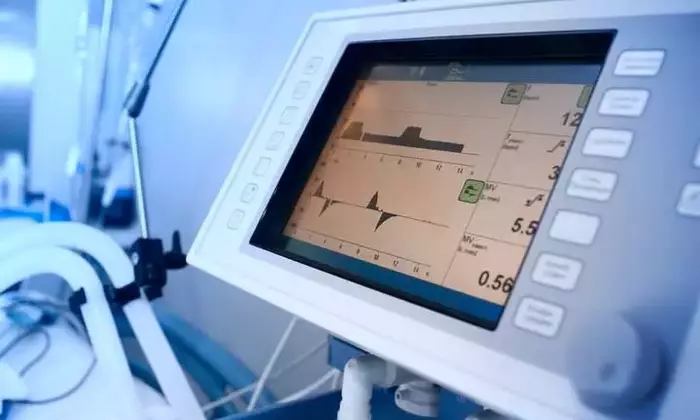 Mechanical Ventilators